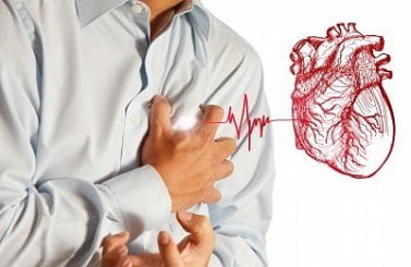 Миокардит сердца симптомы и лечение