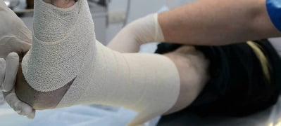 Язвы на ступнях ног лечение thumbnail